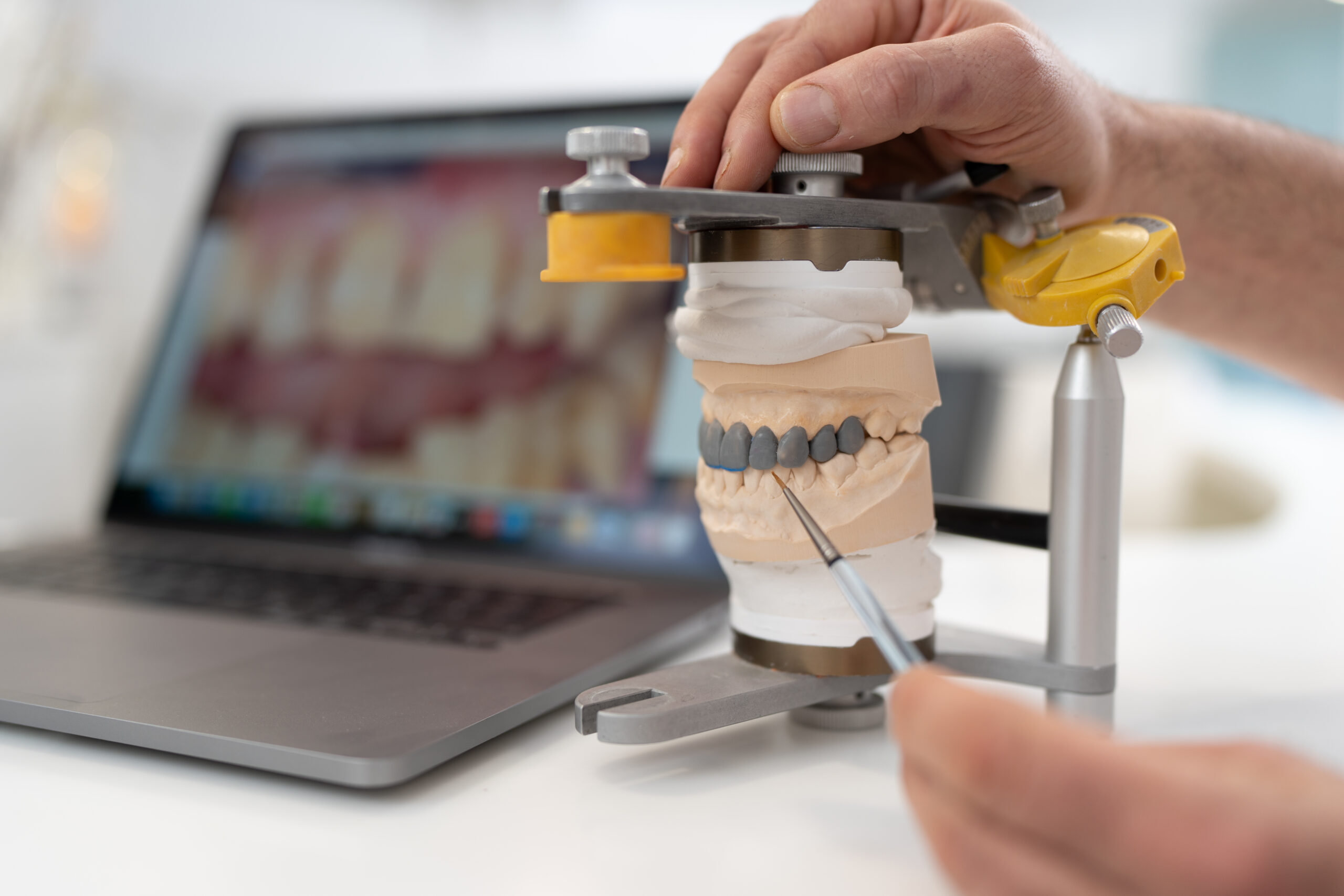 Veneers München, Stachus Innenstadt Zahnarzt Test form